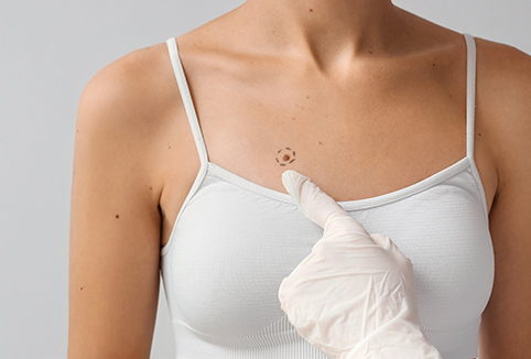 Oncologica Surgery Image