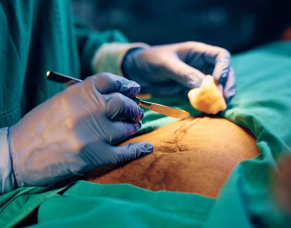 cosmetic treatments for moms SA